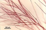 9 - Ramuli con cellule madri delle spermatocisti